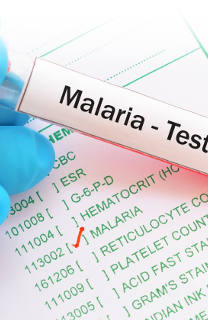 Malaria Image